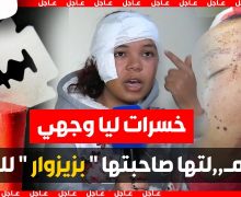 أول خروج اعلامي .. لي شرملتها صاحبتها بزيزوار لوجهها بنواحي المحمدية