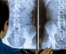 مراكش…رحلة لكوكايين داخل أمعاء زوج وزوجة برازيليان تنتهي بالمطار
