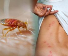 وزارة الصحة والحماية الاجتماعية تطمئن  المواطنين والمواطنات  بخصوص بق الفراش وتحدر ( بلاغ )