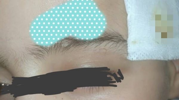 طفل  من فاس يناشد المحسنين ساعدوني في إجراء العملية الجــــ..ـراحــ..ـية الثانية / الهاتف/ 0714342059