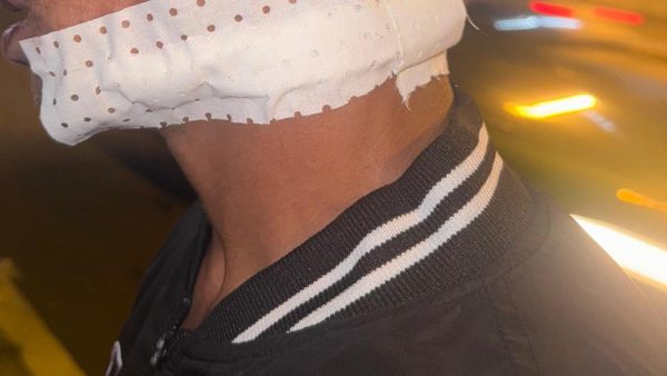 المحمدية… توقيف  “حيقو” بعد محاولته قتل شاب ب (كرادة ) للعنق