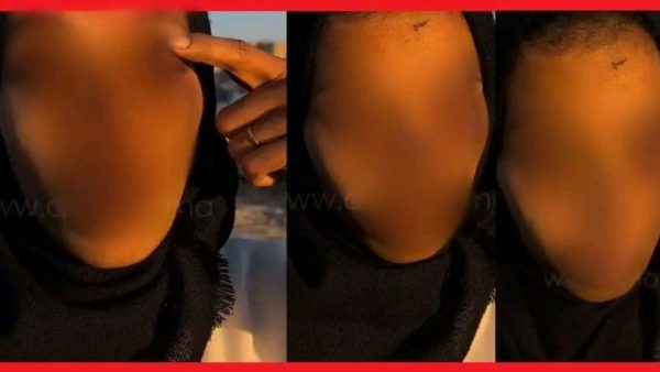 الدارالبيضاء …توقيف شخص اعتدى على سيدة وتسبب لها في جروح بليغة بعينيها