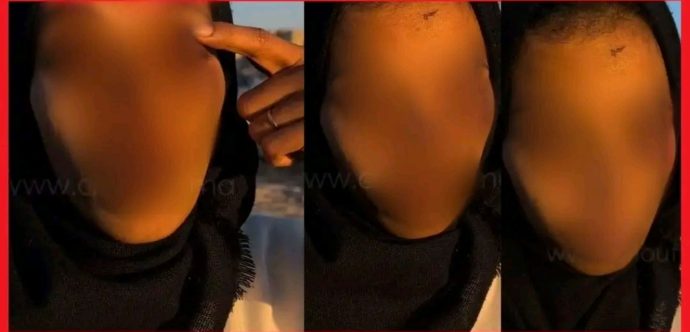 الدارالبيضاء …توقيف شخص اعتدى على سيدة وتسبب لها في جروح بليغة بعينيها