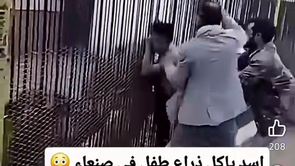 مشهد مـ ـروع ….أسد يبتر دراع طـ ـفل في حديقة حيوان باليمن ( فيديو)