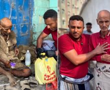 حقيقة لا تصدق .. من من دكتور عظام مشهور باليمن إلى متشرد لم يبقَ منه إلا العظام