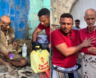 حقيقة لا تصدق .. من من دكتور عظام مشهور باليمن إلى متشرد لم يبقَ منه إلا العظام