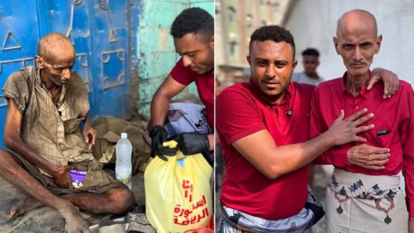 حقيقة لا تصدق .. من من دكتور عظام مشهور باليمن إلى متشرد لم يبقَ منه إلا العظام