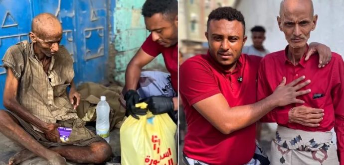 حقيقة لا تصدق .. من من دكتور عظام مشهور باليمن إلى متشرد لم يبقَ منه إلا العظام